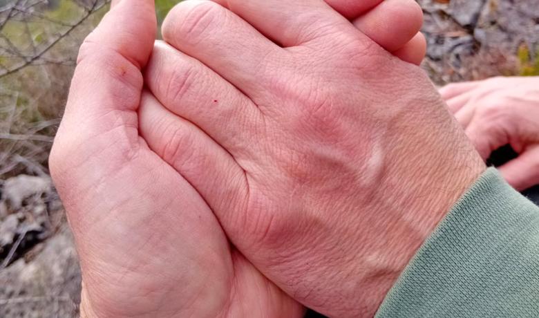 TDAH, Alta Sensibilitat i Dependència emocional en les Relacions afectives